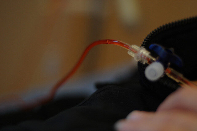 Los escalofríos de la quimioterapia, parte&nbsp;I